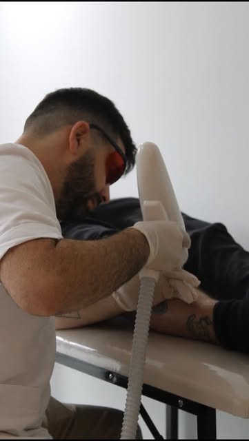 Tratamiento de remoción de tatuaje por láser en InkOFF Laser